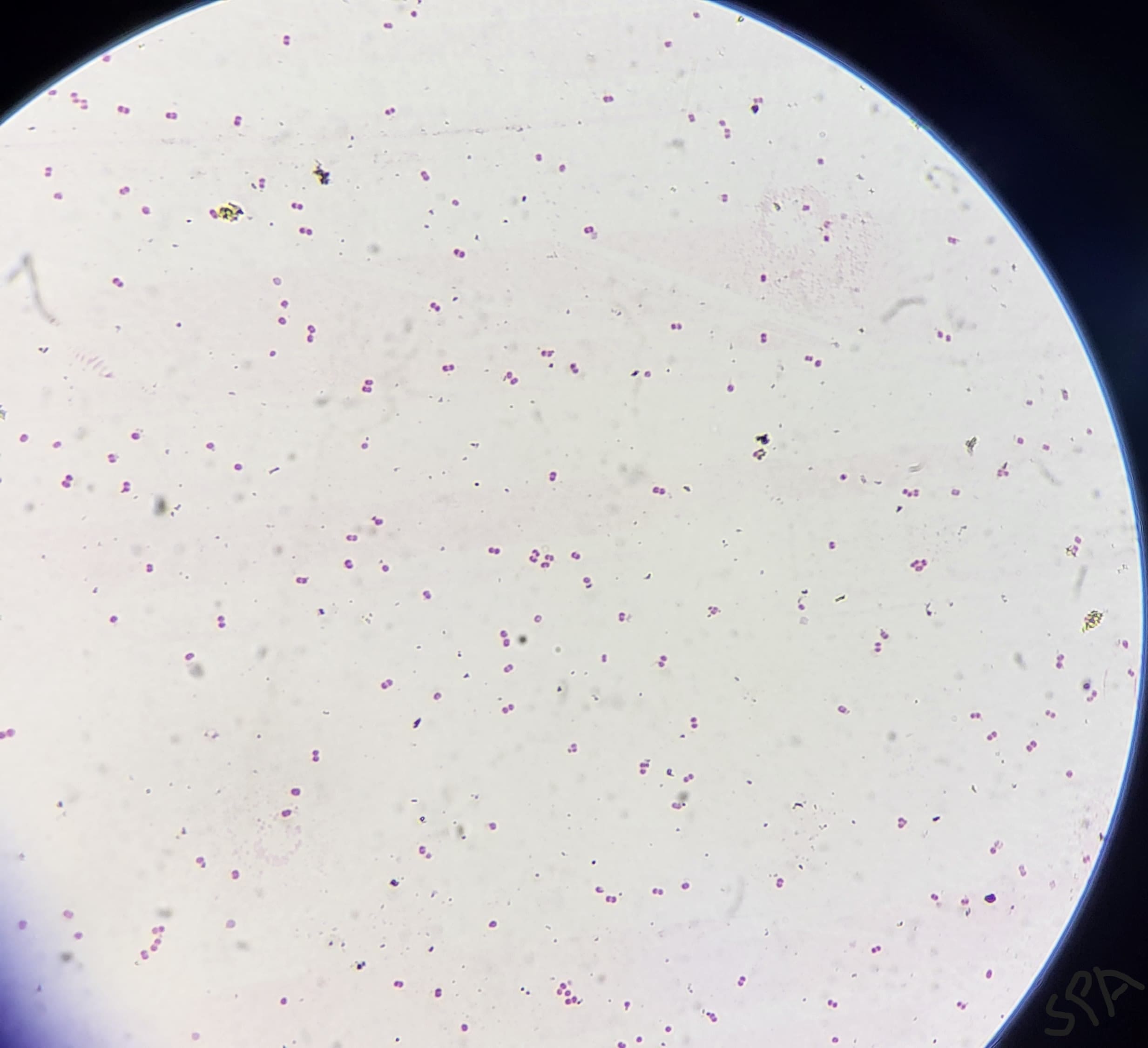 16. Anaerococci
